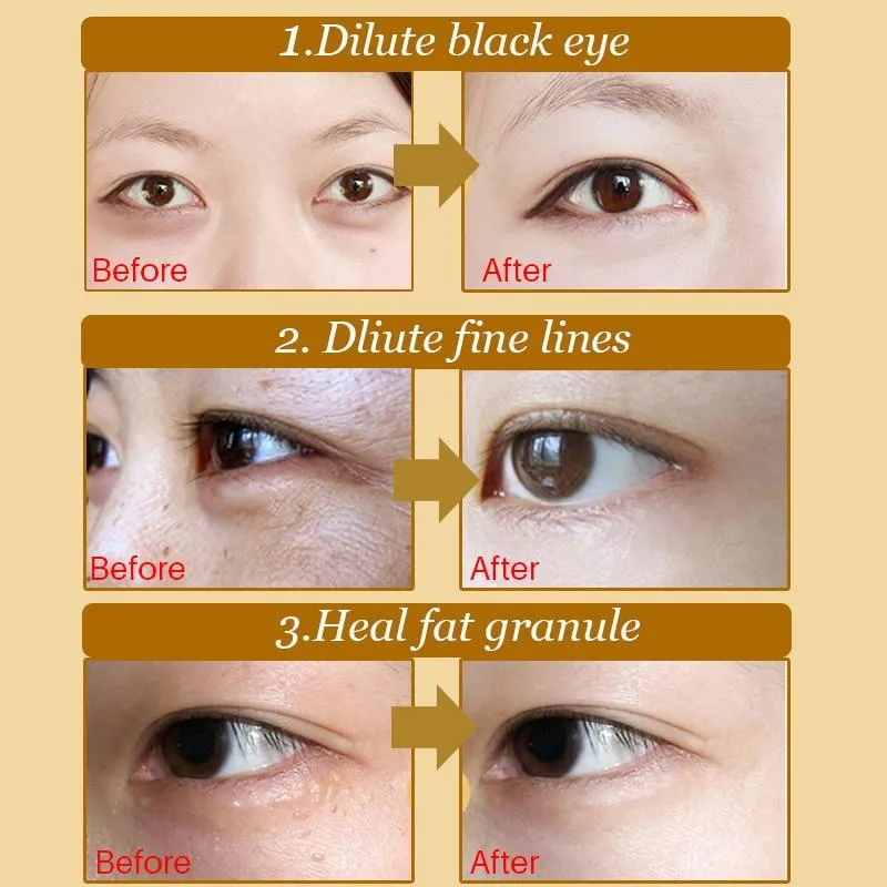 20Pcs Crystal Collagen Anti-Aging Dark Circles Acne Beauty Gold Eye Mask