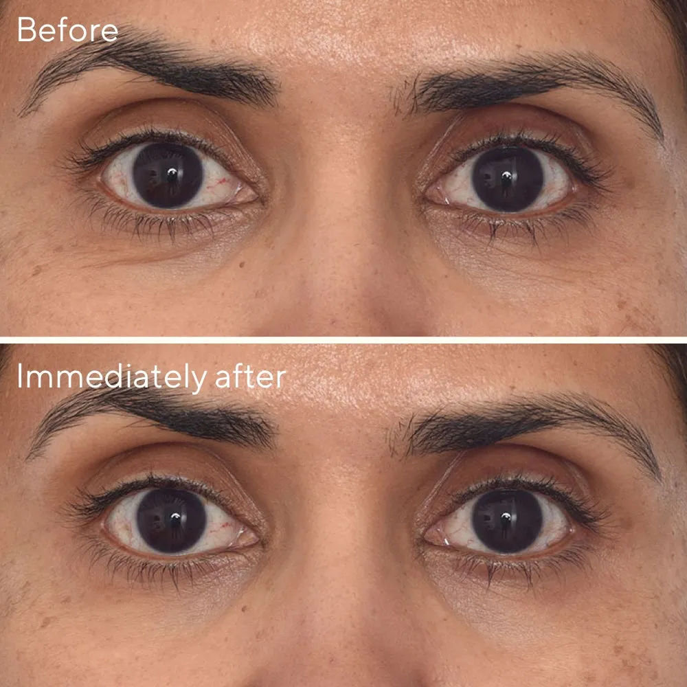 Retinol Youth Renewal Eye Masks