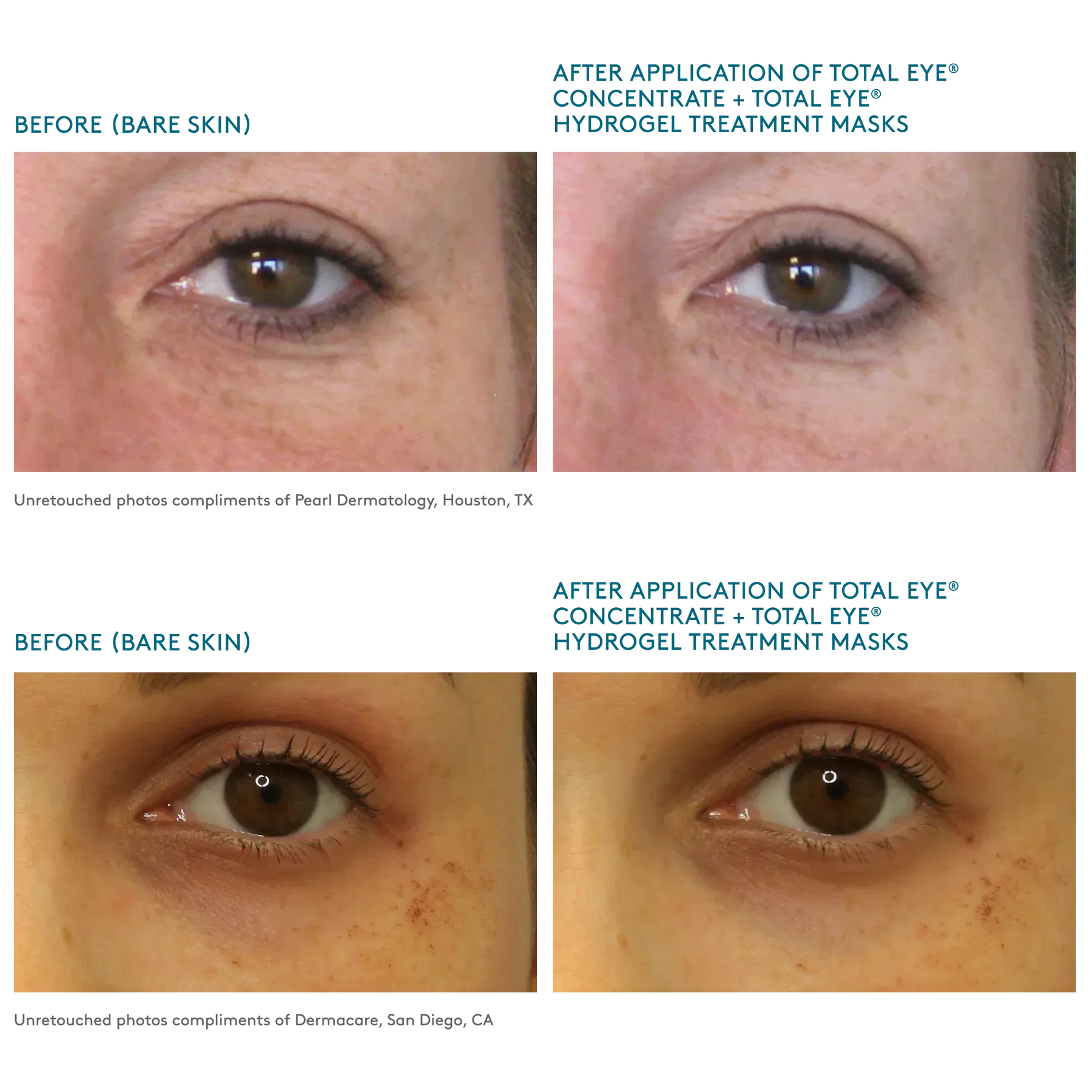 Total Eye® Serum & Hydrogel Masks